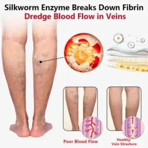 SEURICO™ Vein Dredge Silkworm Extract Spray