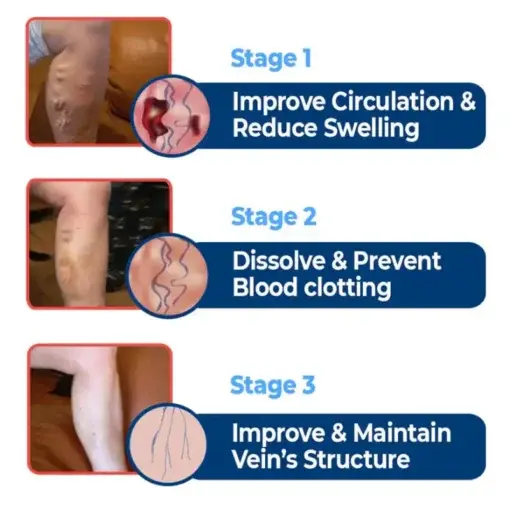 SEURICO™ Vein Dredge Silkworm Extract Spray