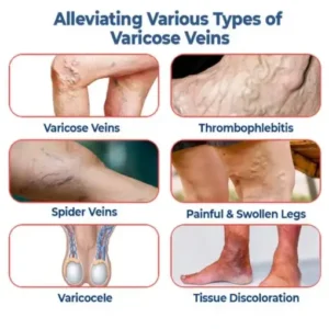 SEURICO™ Vein Dredge Silkworm Extract Spray