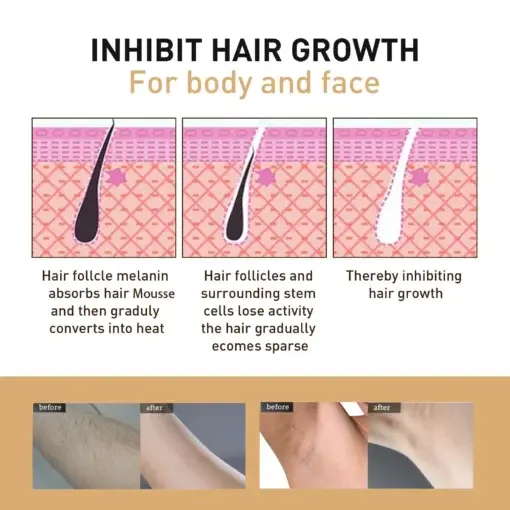 Seurico™ BeeSilk Hair Removal Mousse