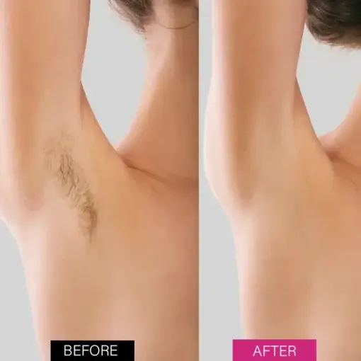 Seurico™ BeeSilk Hair Removal Mousse