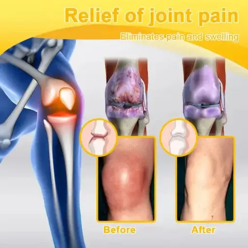 Seurico™ Botulinum Toxin & Bee Venom Pain-Relief Bone Healing Cream