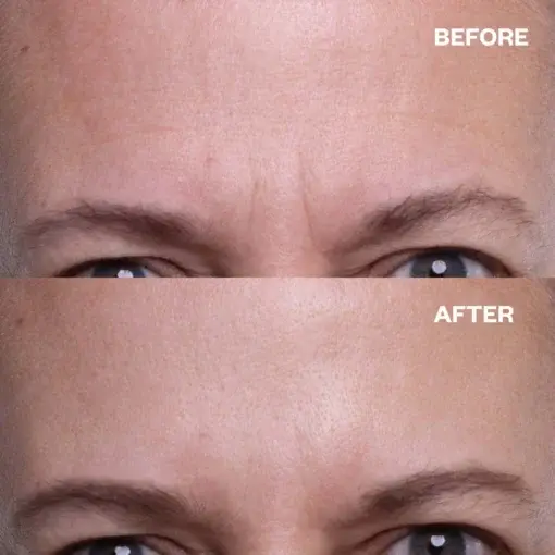 Seurico™ Forehead Wrinkle Patches