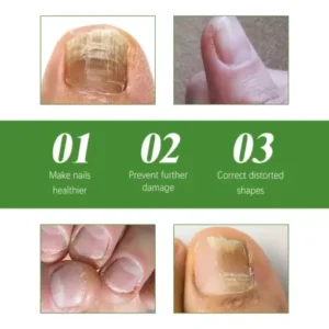 Seurico™ Fungal Inhibiting Stick