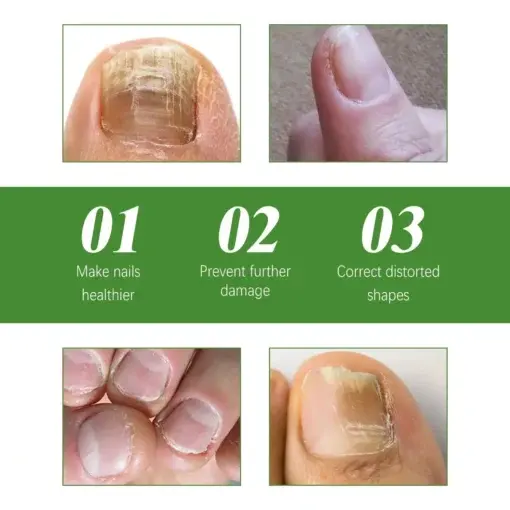 Seurico™ Fungal Inhibiting Stick