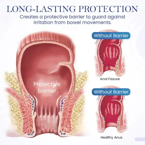 Seurico™ Herbal Hemorrhoid Treatment