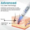 Seurico™ Laser Pen – Non-invasive Mole and Wart Removal