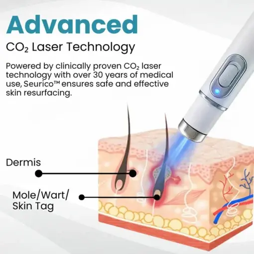Seurico™ Laser Pen – Non-invasive Mole and Wart Removal