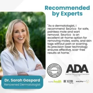 Seurico™ Laser Pen – Non-invasive Mole and Wart Removal