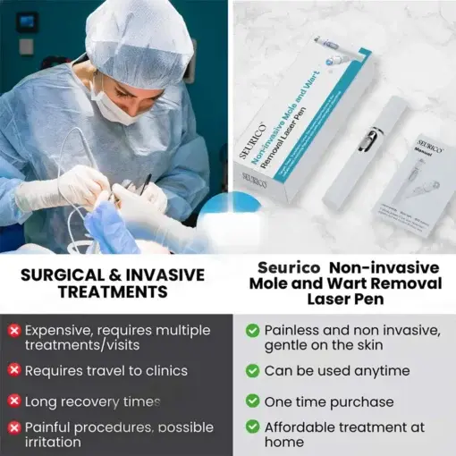 Seurico™ Laser Pen – Non-invasive Mole and Wart Removal