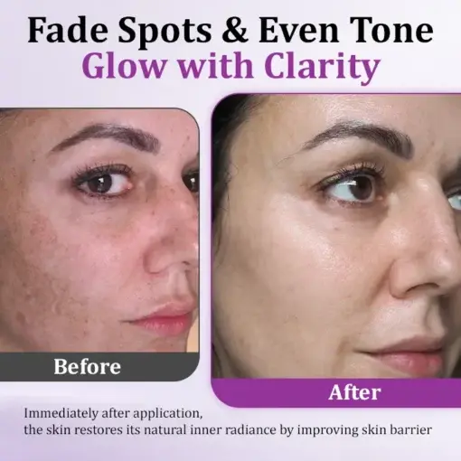 Seurico™ MelantraY Anti-Hyperpigmentation Essence