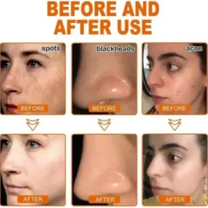 Seurico™ Whitening and Freckle – Removing Mask