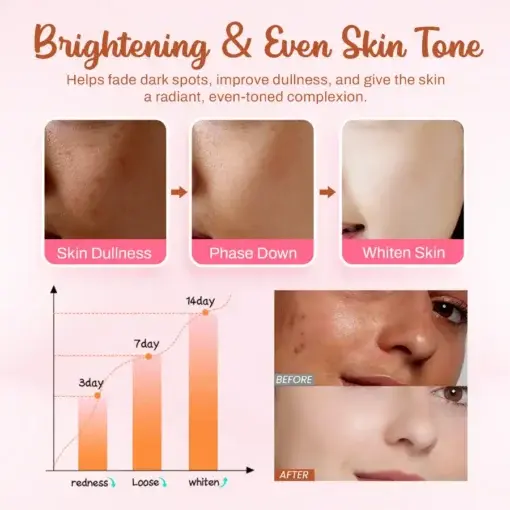 Seurico™ Whitening and Freckle – Removing Mask